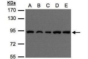 WB Image Sample(30 μg of whole cell lysate) A:H1299 B:HeLa S3 , C:Hep G2 , D:MOLT4 , E:Raji , 7. (VPS35 Antikörper  (C-Term))