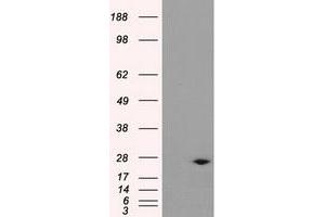 Western Blotting (WB) image for anti-Dicarbonyl/L-Xylulose Reductase (DCXR) antibody (ABIN1497787) (DCXR Antikörper)
