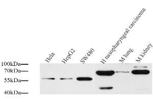 Western Blot analysis of various samples using CD54 Polyclonal Antibody at dilution of 1:1000. (ICAM1 Antikörper)