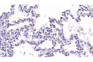 Detection of CFTR in Human Lung Tissue using Polyclonal Antibody to Cystic Fibrosis Transmembrane Conductance Regulator (CFTR) (CFTR Antikörper)