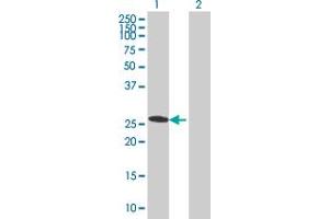 Western Blotting (WB) image for SNRPN 293T Cell Transient Overexpression Lysate(Denatured) (ABIN1333533)