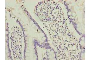 Immunohistochemistry of paraffin-embedded human small intestine tissue using ABIN7162226 at dilution of 1:100 (PLAC1L Antikörper  (AA 74-158))