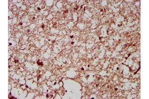 IHC image of ABIN7161362 diluted at 1:200 and staining in paraffin-embedded human brain tissue performed on a Leica BondTM system. (NrCAM Antikörper  (AA 1194-1299))