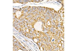 Immunohistochemistry (IHC) image for anti-Prohibitin (PHB) (AA 73-272) antibody (ABIN3020628)