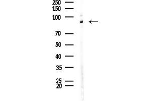 anti-Topoisomerase (DNA) I (TOP1) (Internal Region) antibody
