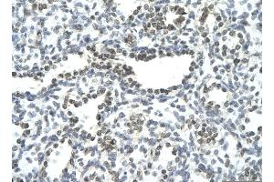 Immunohistochemistry (IHC) image for anti-Nuclear Factor of Activated T-Cells, Cytoplasmic, Calcineurin-Dependent 3 (NFATC3) (N-Term) antibody (ABIN2792685)