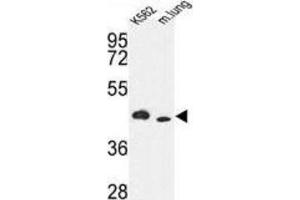 Western Blotting (WB) image for anti-Inositol-Trisphosphate 3-Kinase A (ITPKA) antibody (ABIN3003733)