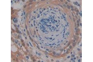 IHC-P analysis of Kidney tissue, with DAB staining. (MEK2 Antikörper  (AA 86-331))