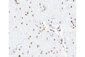 ABIN6267065 at 1/100 staining human Brain tissue sections by IHC-P. (Histone 3 Antikörper  (H3K18ac))