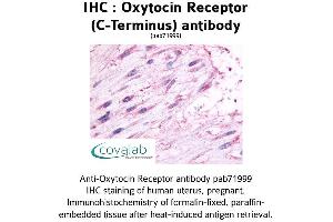 Image no. 1 for anti-Oxytocin Receptor (OXTR) (C-Term), (Cytoplasmic Domain) antibody (ABIN1737738) (Oxytocin Receptor Antikörper  (C-Term, Cytoplasmic Domain))