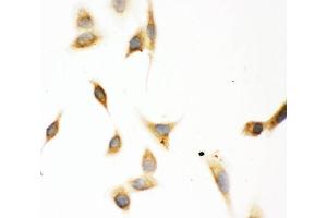 IHC analysis of ASPH using anti-ASPH antibody (ABIN3043790).