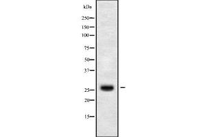 Western blot analysis of CLDN14 using HuvEc whole cell lysates (CLDN14 Antikörper  (C-Term))