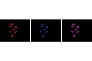 Immunofluorescence Microscopy of anti-Pol II antibody Immunofluorescence Microscopy results of Mouse anti-Pol II antibody. (POLR2A/RPB1 Antikörper)