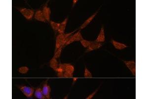 Immunofluorescence (IF) image for anti-Aldo-Keto Reductase Family 1, Member C3 (3-alpha Hydroxysteroid Dehydrogenase, Type II) (AKR1C3) antibody (ABIN7259737)