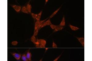 Immunofluorescence analysis of NIH/3T3 cells using AKR1C3 Polyclonal Antibody at dilution of 1:100. (AKR1C3 Antikörper)