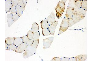 Anti- CPT1B Picoband antibody, IHC(P) IHC(P): Mouse Skeletal Muscle Tissue