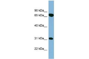WB Suggested Anti-HIRIP3 Antibody Titration: 0. (HIRIP3 Antikörper  (Middle Region))