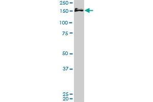 MLLT10 monoclonal antibody (M02), clone 2B9. (MLLT10 Antikörper  (AA 695-793))