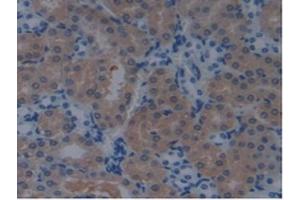 Detection of PDCD6IP in Mouse Kidney Tissue using Polyclonal Antibody to Programmed Cell Death Protein 6 Interacting Protein (PDCD6IP)
