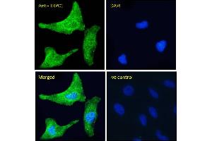 ABIN6391351 Immunofluorescence analysis of paraformaldehyde fixed HeLa cells, permeabilized with 0.