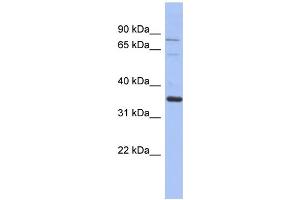 WB Suggested Anti-NRBP2 Antibody Titration: 0. (NRBP2 Antikörper  (Middle Region))