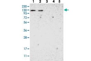 Western blot analysis of Lane 1: RT-4, Lane 2: U-251 MG, Lane 3: Human Plasma, Lane 4: Liver, Lane 5: Tonsil with ADNP2 polyclonal antibody  at 1:250-1:500 dilution.