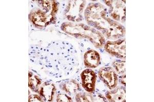 Immunohistochemistry analysis in formalin fixed and paraffin embedded human kidney tissue reacted with PDZK1 Antibody (Center) followed by peroxidase conjugation of the secondary antibody and DAB staining.