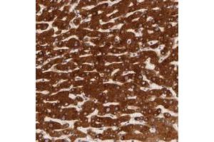 Immunohistochemical staining of human liver with PACS2 polyclonal antibody  shows strong cytoplasmic positivity in hepatocytes at 1:50-1:200 dilution. (PACS2 Antikörper)