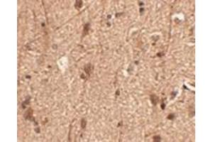 Immunohistochemistry of Slitrk3 in human brain tissue with AP30802PU-N Slitrk3 antibody at 2.