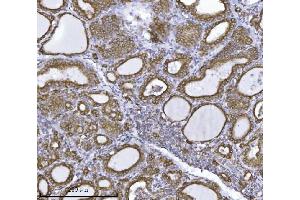 IHC analysis of ERLIN2 using anti-ERLIN2 antibody (ABIN7602582).