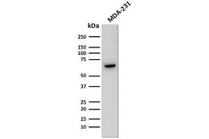 Western Blot Analysis of Human MDA-231 cell lysate using GnRH-Receptor Mouse Monoclonal Antibody (F1G4). (GNRHR and LHCGR (AA 1-29), (N-Term) Antikörper)