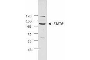Western Blotting (WB) image for anti-Signal Transducer and Activator of Transcription 6, Interleukin-4 Induced (STAT6) antibody (ABIN2666296) (STAT6 Antikörper)