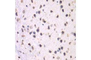 Immunohistochemistry of paraffin-embedded mouse brain using PRMT5 antibody at dilution of 1:100 (x40 lens). (PRMT5 Antikörper)