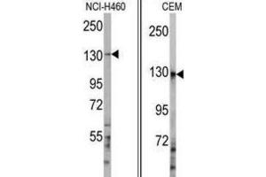 Western Blotting (WB) image for anti-Ubiquitination Factor E4A (UBE4A) antibody (ABIN3001447) (UBE4A Antikörper)