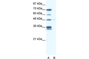 Western Blotting (WB) image for anti-GLIS Family Zinc Finger 2 (GLIS2) antibody (ABIN2460153) (GLIS2 Antikörper)