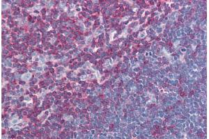 Human Thymus (formalin-fixed, paraffin-embedded) stained with LCP2 antibody ABIN239827 at 10 ug/ml followed by biotinylated anti-mouse IgG secondary antibody ABIN481714, alkaline phosphatase-streptavidin and chromogen. (LCP2 Antikörper  (AA 216-434))