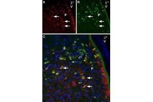 Multiplex staining of Melatonin receptor type 1B and NaV1. (SCN2A Antikörper  (Intracellular))