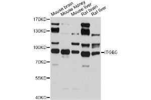 Western blot analysis of extracts of various cell lines, using ITGB5 antibody.