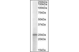 Image no. 1 for anti-Adenylate Cyclase Activating Polypeptide 1 (Pituitary) (ADCYAP1) (C-Term) antibody (ABIN453980) (PACAP Antikörper  (C-Term))