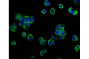Immunofluorescence staining of MCF-7 cells with ABIN7162123 at 1:133, counter-stained with DAPI. (Occludin Antikörper  (AA 285-430))