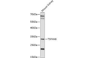 Western blot analysis of extracts of Mouse kidney, using TSP antibody (ABIN7270790) at 1:1000 dilution. (Tetraspanin 6 Antikörper  (AA 120-200))