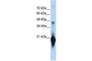 Western Blotting (WB) image for anti-Chromosome 17 Open Reading Frame 49 (C17orf49) antibody (ABIN2459653) (C17orf49 Antikörper)