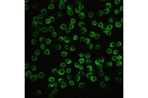 Immunohistochemistry (IHC) image for anti-NLR Family, Pyrin Domain Containing 3 (NLRP3) (AA 12-31), (N-Term) antibody (ABIN3044250)