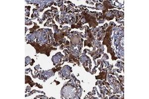 Immunohistochemical staining of human lung with DNHD1 polyclonal antibody  shows strong cytoplasmic positivity in macrophages. (DNHD1 Antikörper)