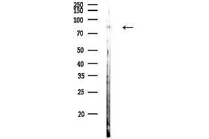 Western blot analysis of lysates from F10-LUC cells, using SLC15 Antibody at 1/1000 dilution.