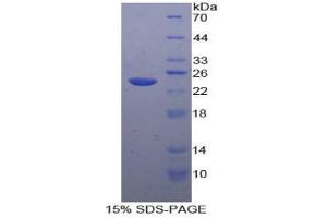 SDS-PAGE analysis of Human Tachykinin Receptor 2 Protein.