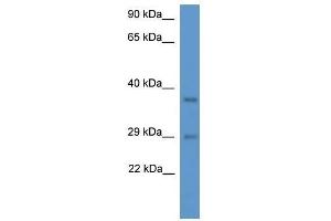 Western Blot showing Med19 antibody used at a concentration of 1. (MED19 Antikörper  (N-Term))
