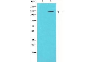 Western blot analysis of p130 Cas expression in NIH-3T3 whole cell lysates,The lane on the left is treated with the antigen-specific peptide. (BCAR1 Antikörper  (Internal Region))