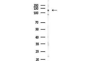 Western blot analysis of lysates from PC12 cells(LPS, 4h treatment), using ASAP1 antibody Antibody at 1/1000 dilution.