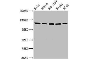 Western Blot Positive WB detected in: Hela whole cell lysate, MCF-7 whole cell lysate, SH-SY5Y whole cell lysate, HepG2 whole cell lysate, A549 whole cell lysate All lanes: USP48 antibody at 3. (USP48 Antikörper  (AA 358-508))